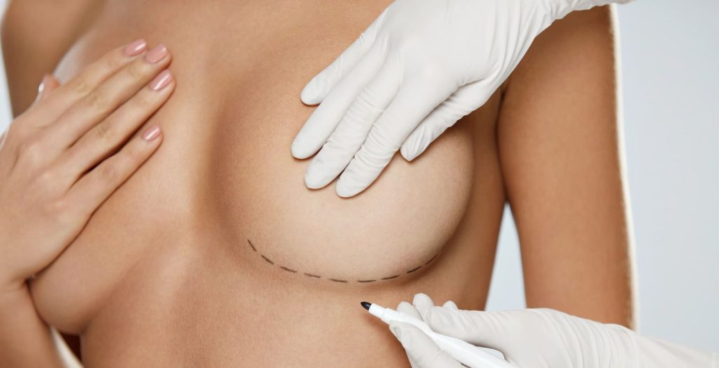 breast implants nj